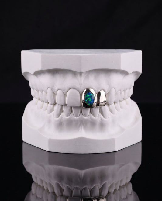 Black Opal custom grillz by AVM Gems