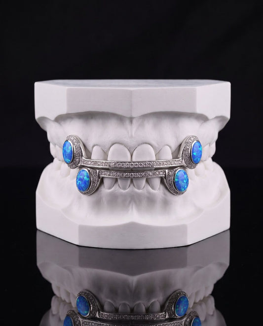 Blue Opal Bars custom grillz by AVM Gems