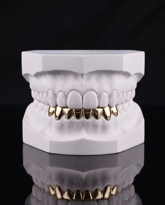 Bottom Bridge custom grillz by AVM Gems