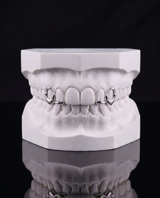 Corner Frames custom grillz by AVM Gems