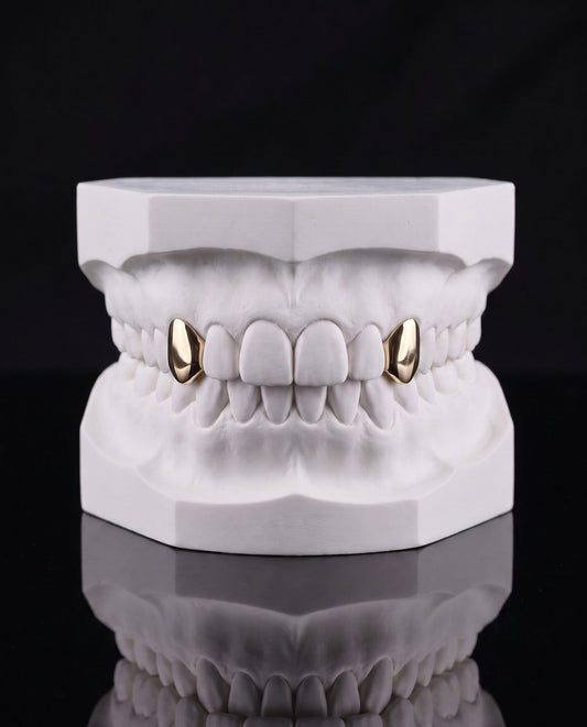 Corners custom grillz by AVM Gems
