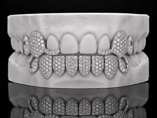 Winged Ice custom grillz by AVM Gems