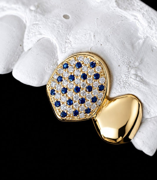 Sapphire Pair custom grillz by AVM Gems