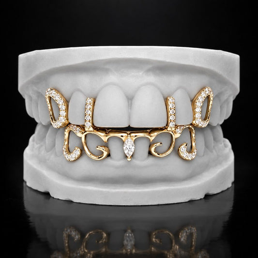 Scroll and Ice custom grillz by AVM Gems