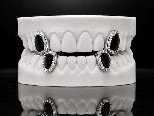 Onyx Frames custom grillz by AVM Gems
