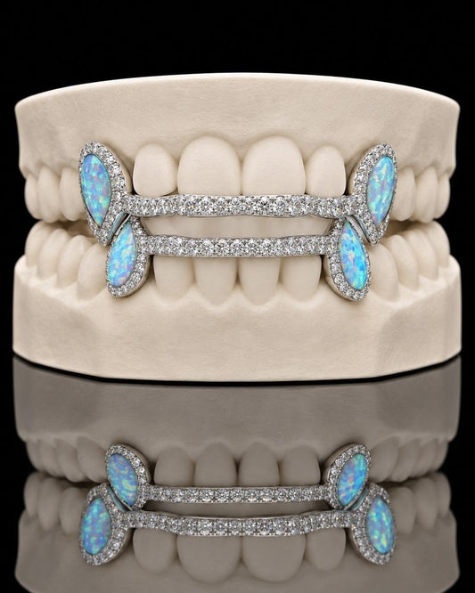 Opal Rails custom grillz by AVM Gems