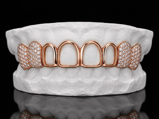 Rose Ice Frames custom grillz by AVM Gems
