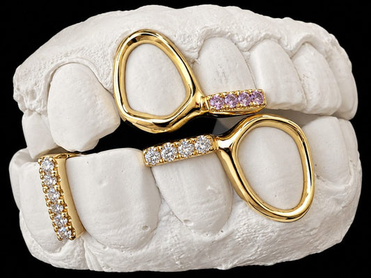 Loop Pair custom grillz by AVM Gems