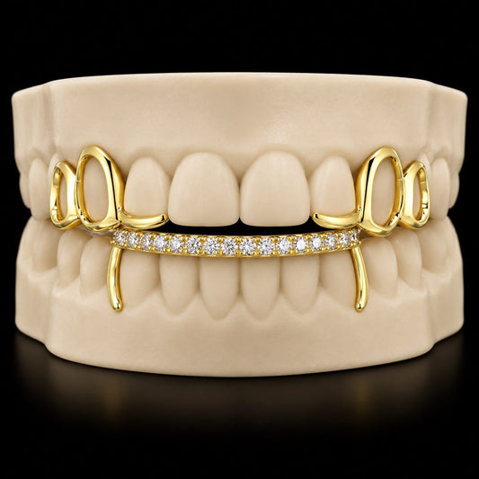 Gold Ice Bar custom grillz by AVM Gems
