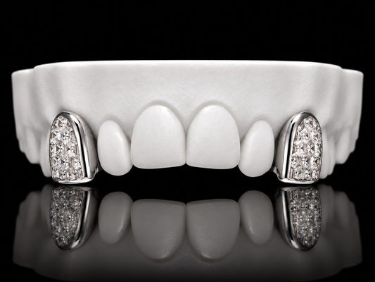 Ice Pair custom grillz by AVM Gems