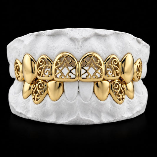 Gold Filigree custom grillz by AVM Gems
