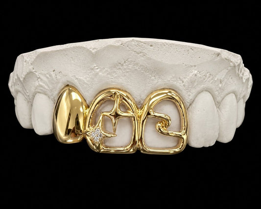 Star Window Trio custom grillz by AVM Gems