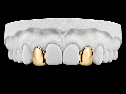 Gold Pair custom grillz by AVM Gems