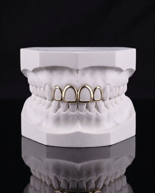 Double Frame custom grillz by AVM Gems