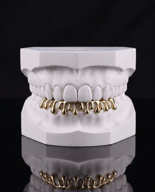 Drip custom grillz by AVM Gems