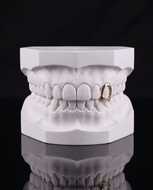 Edge custom grillz by AVM Gems