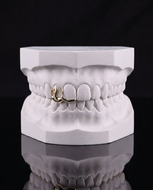 Flame custom grillz by AVM Gems