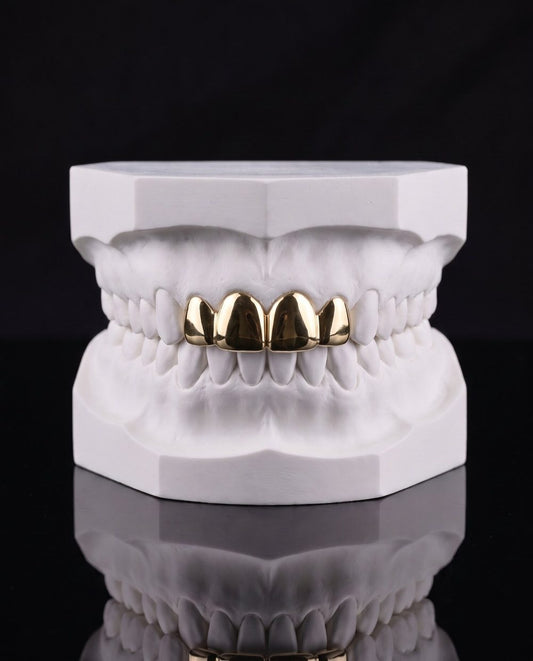 Front Two custom grillz by AVM Gems