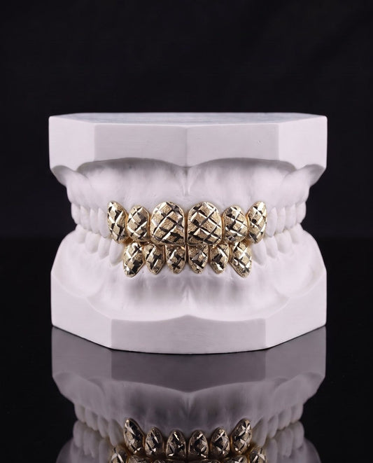 Gold Cut custom grillz by AVM Gems
