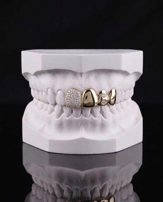 Ice and Stone custom grillz by AVM Gems