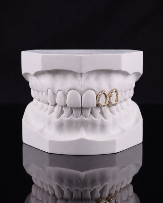 Iced Frames Pair custom grillz by AVM Gems