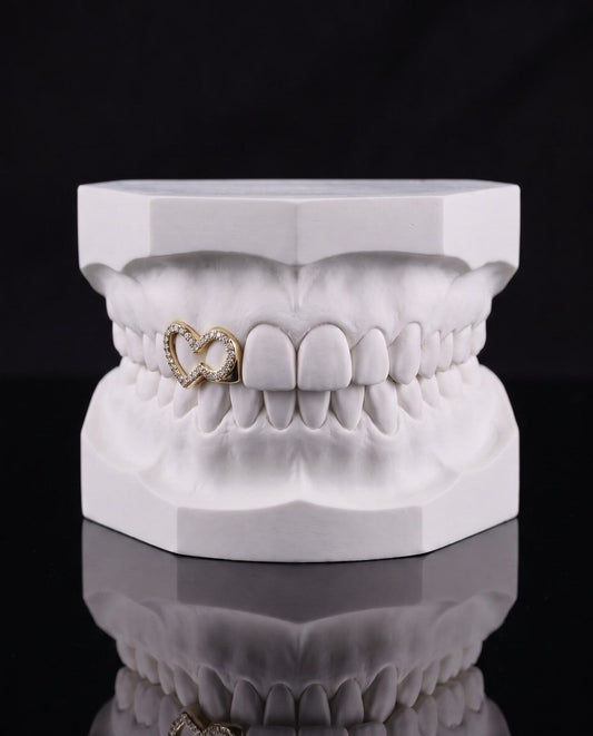 Iced Heart custom grillz by AVM Gems