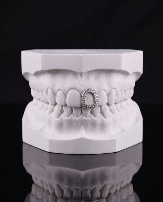 Iced Window custom grillz by AVM Gems
