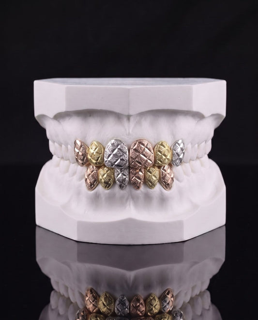 Mixed Metal custom grillz by AVM Gems