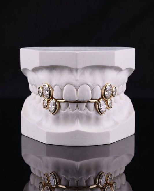Petals custom grillz by AVM Gems