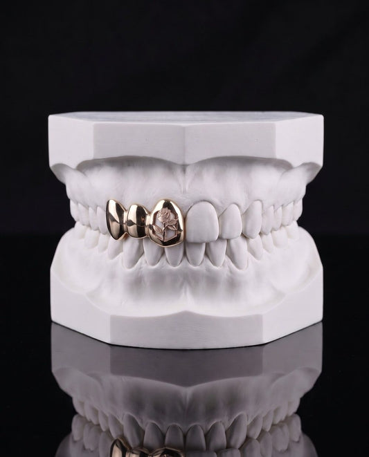 Rose Engraved custom grillz by AVM Gems