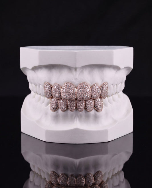 Rosé Full custom grillz by AVM Gems