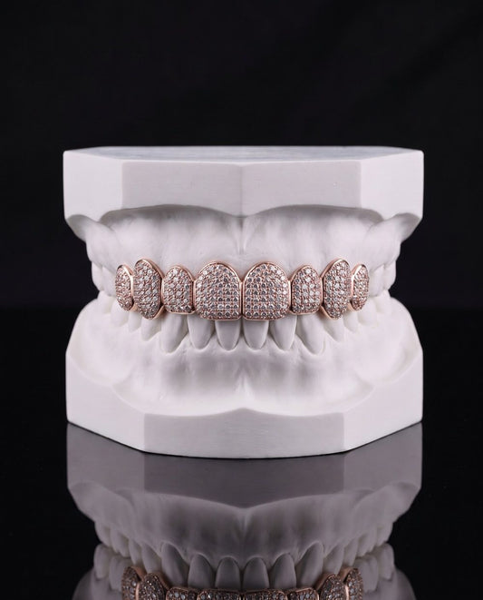 Rosé Row custom grillz by AVM Gems