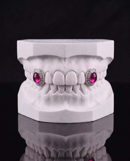 Rouge Pair custom grillz by AVM Gems