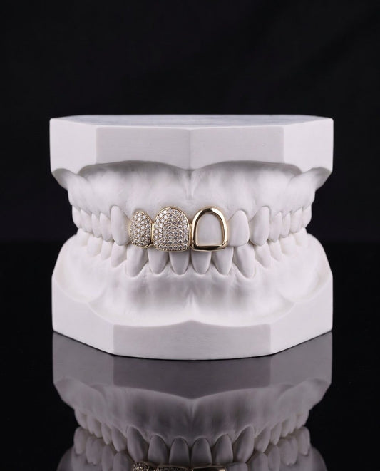 Side by Side custom grillz by AVM Gems