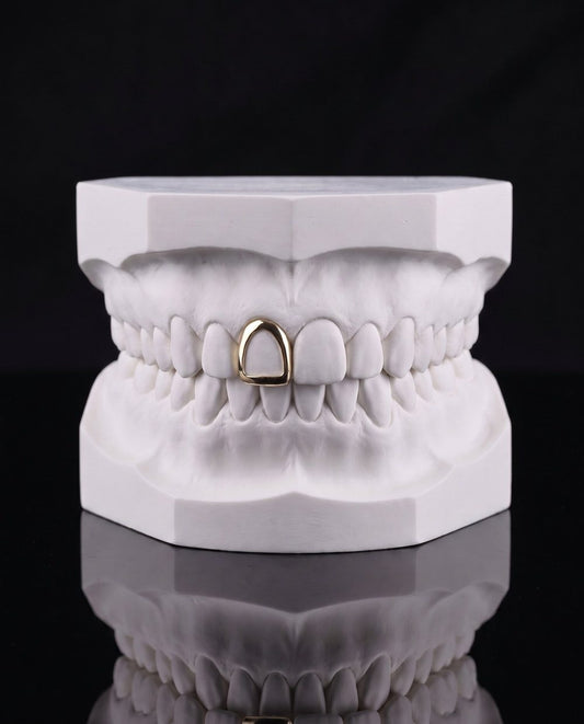 Side Frame custom grillz by AVM Gems