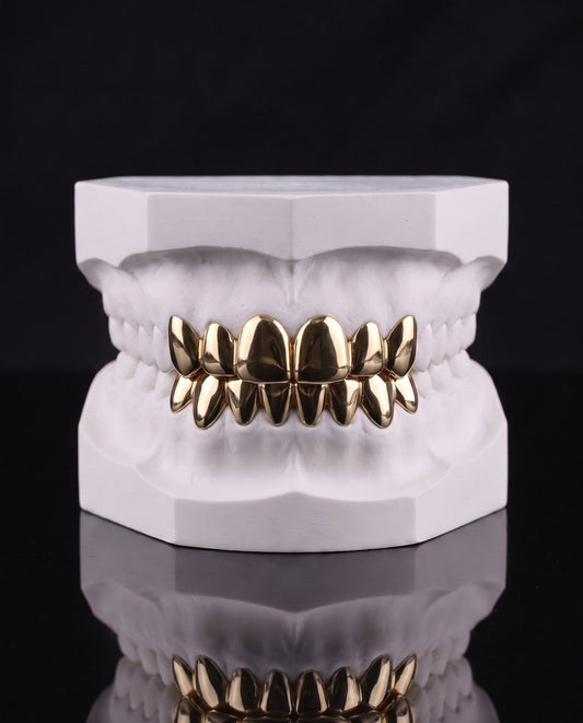 Solid Gold custom grillz by AVM Gems