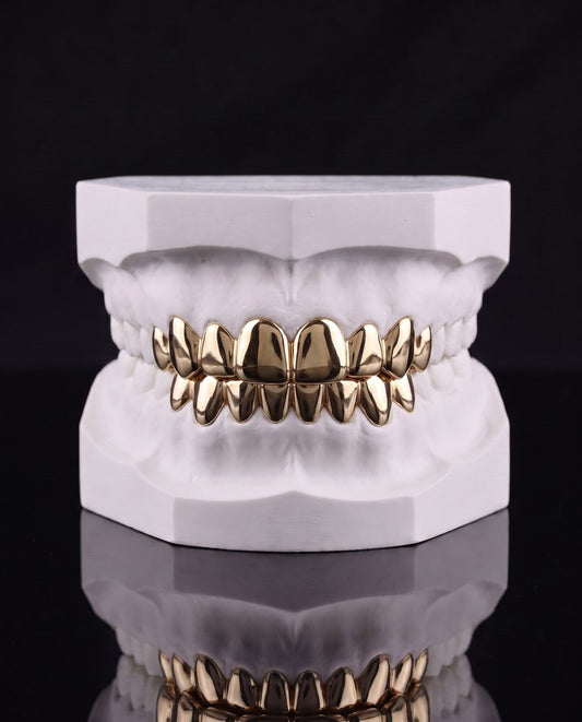 Solid Set custom grillz by AVM Gems