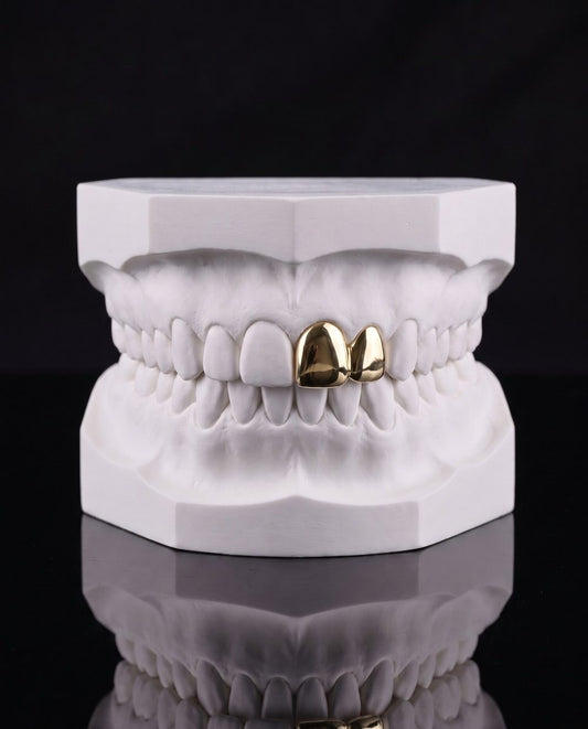 Solo Gold custom grillz by AVM Gems