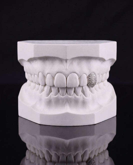 Solo custom grillz by AVM Gems