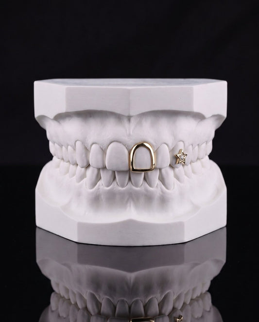 Star Frame II custom grillz by AVM Gems
