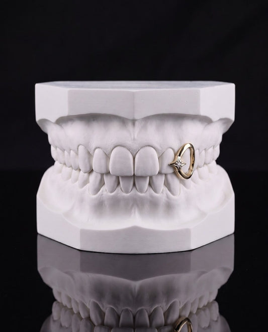 Star Frame custom grillz by AVM Gems