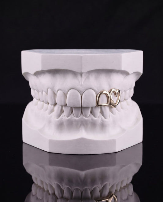 Sweethearts custom grillz by AVM Gems