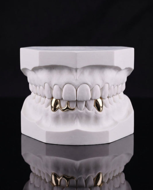 Two Down custom grillz by AVM Gems