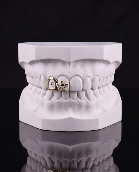 Wildflower custom grillz by AVM Gems